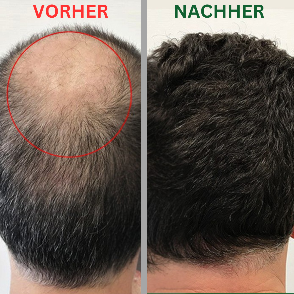Vemoro™ Natürliches Haaröl